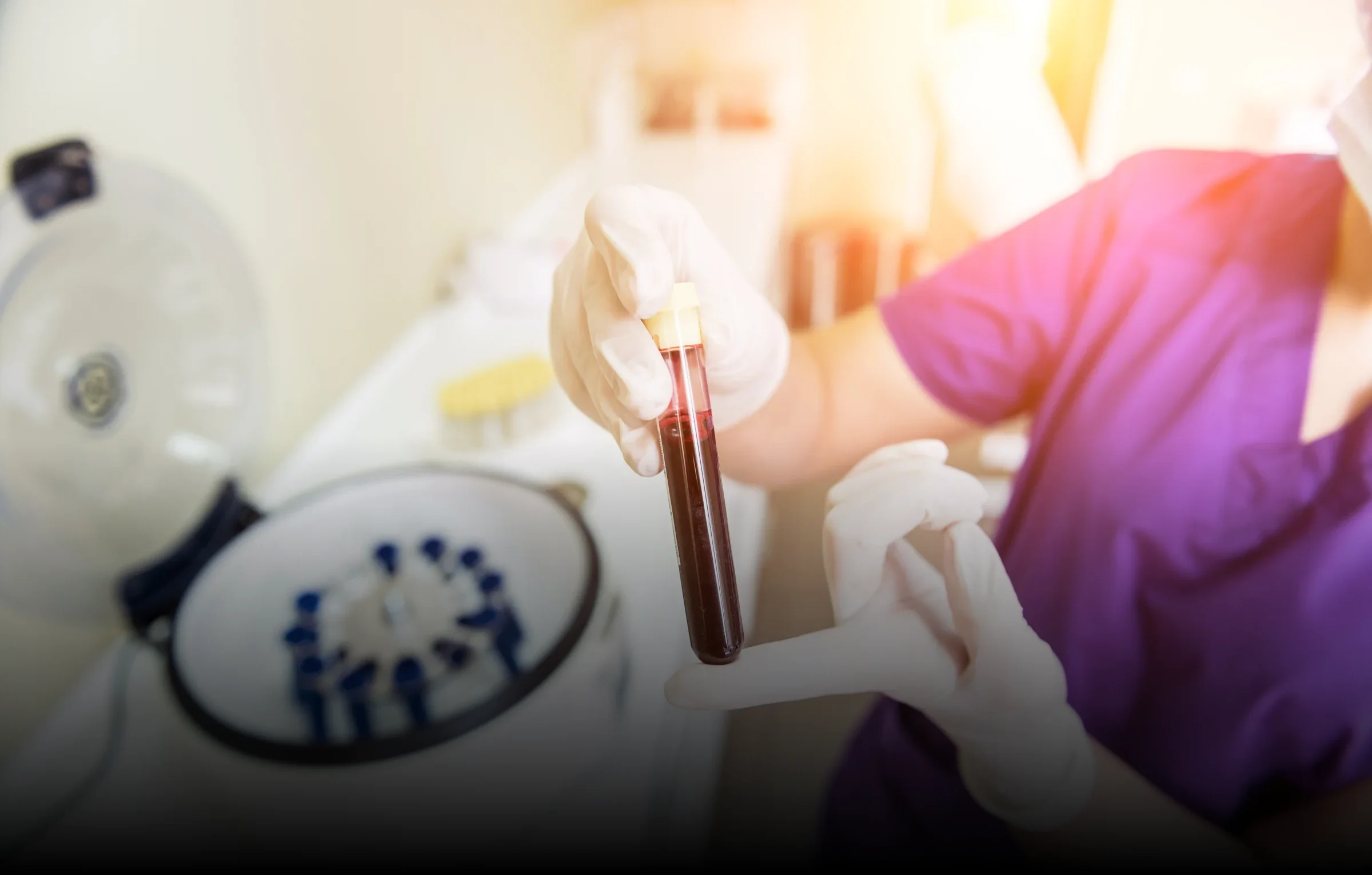 Navigovaná aplikácia autológnej plazmy - PRP